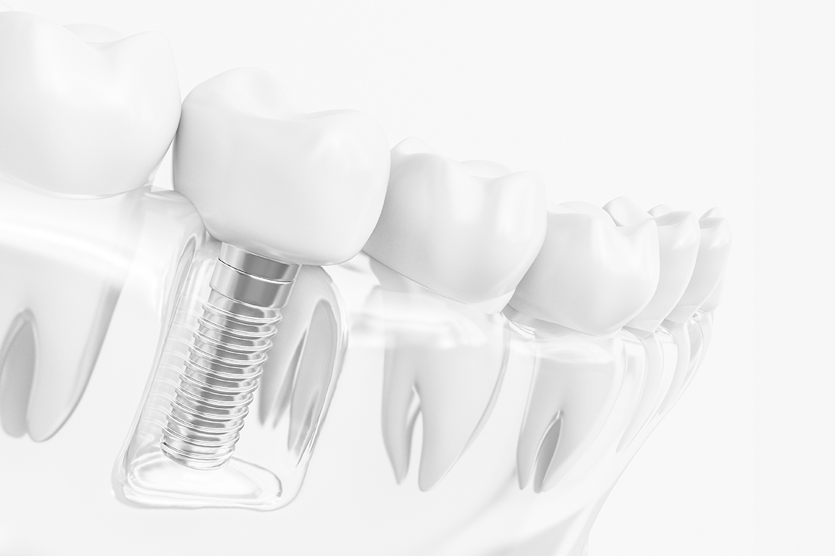 Features of Aoyama 1-chome Azabu Dental Clinic