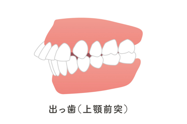 審美治療