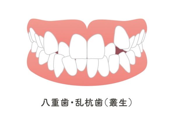 審美治療