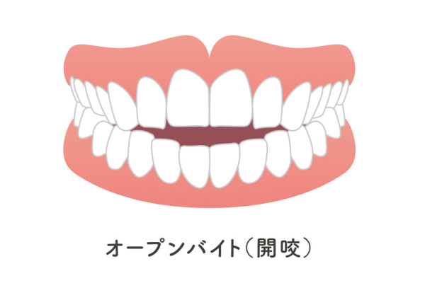 審美治療