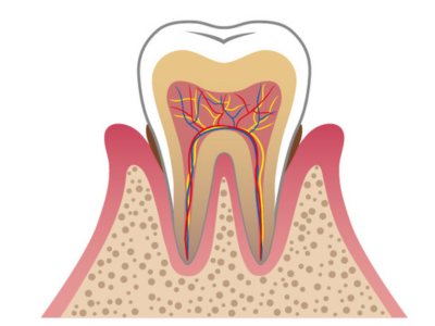 歯周病治療