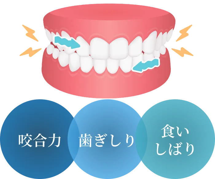 咬合力、歯ぎしり、食いしばりが歯に負担をかける様子