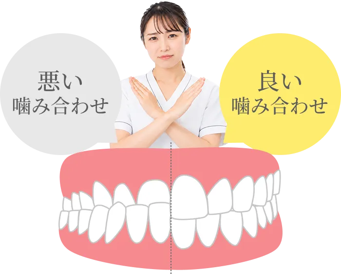 良い噛み合わせと悪い噛み合わせを比較した図