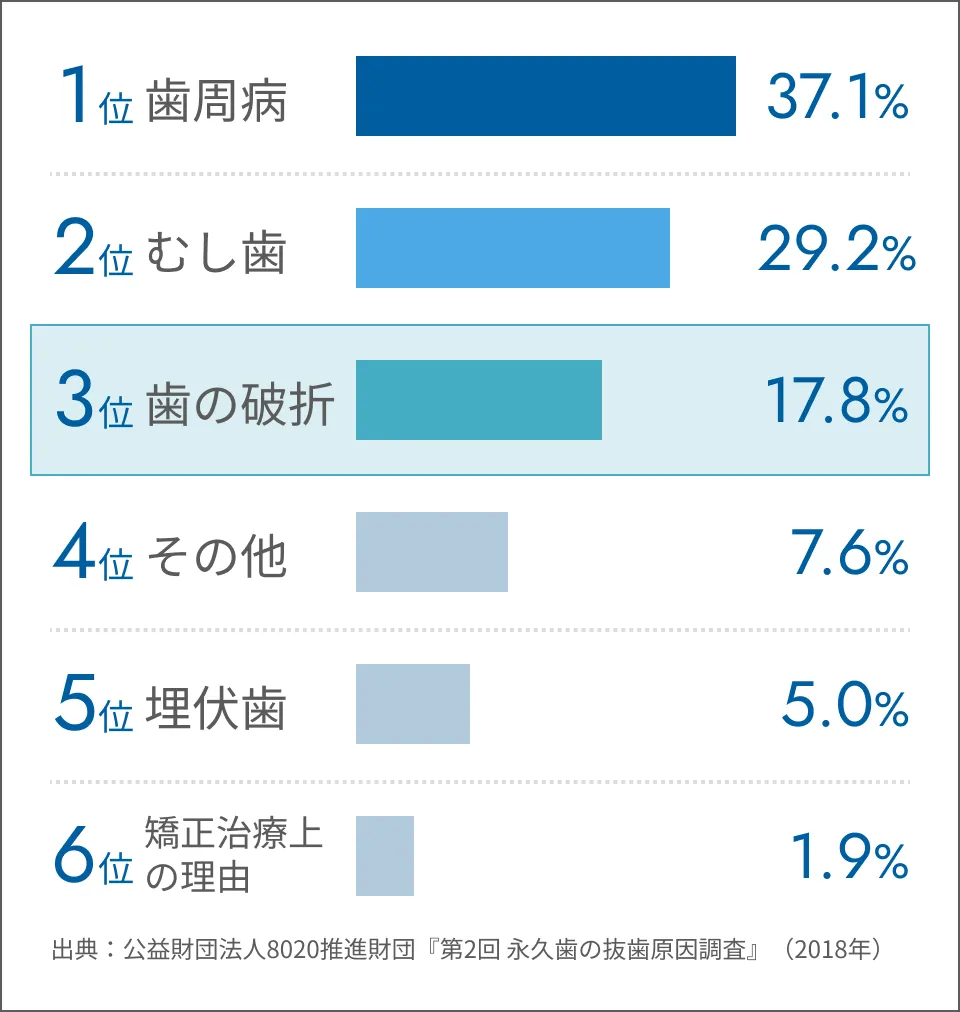 永久歯の抜歯原因ランキング。1位は歯周病37.1%、2位はむし歯29.2%、3位は歯の破折17.8%