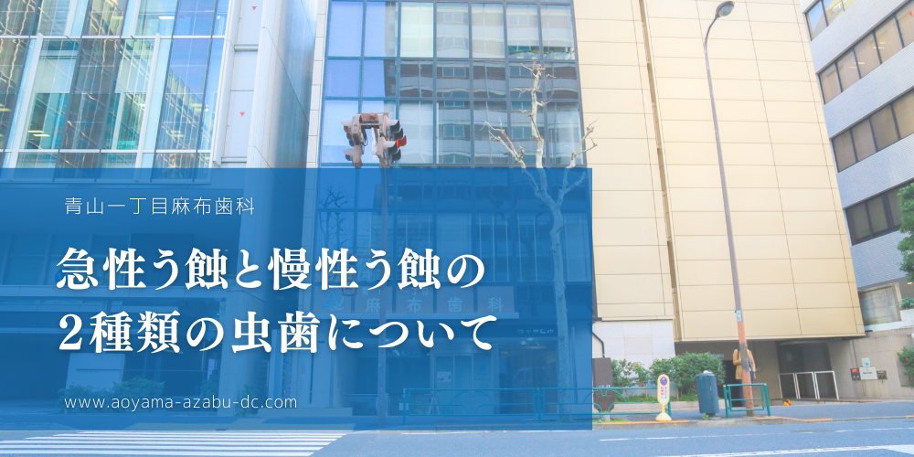 急性う蝕と慢性う蝕の２種類の虫歯について